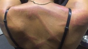 LASU Final Year Student Seeks Justice After Alleged Assault by Landlord and His Mother